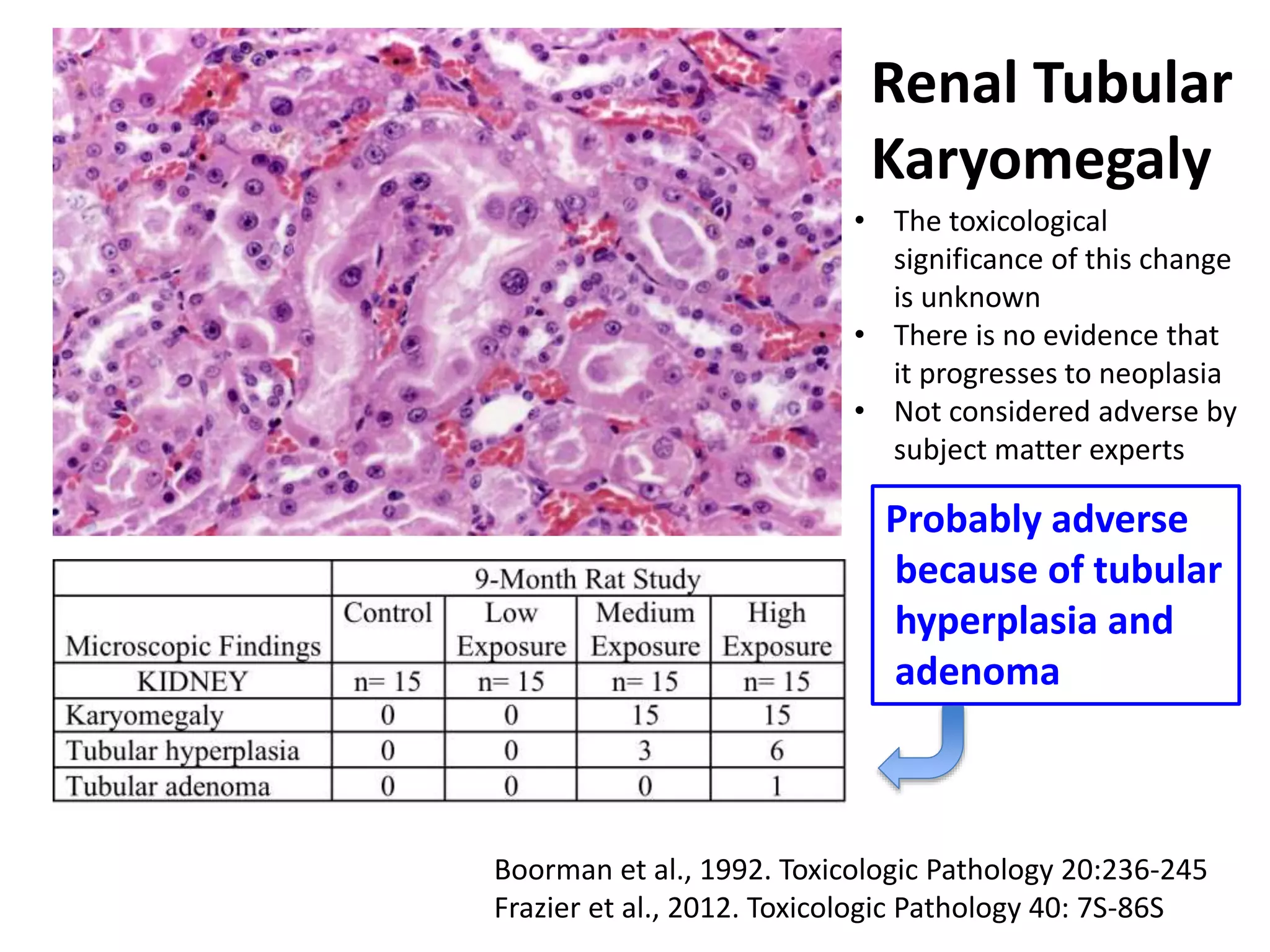 Renal Tubular
Karyomegaly
Boorman et al., 1992. Toxicologic Pathology 20:236-245
Frazier et al., 2012. Toxicologic Pathology 40: 7S-86S
• The toxicological
significance of this change
is unknown
• There is no evidence that
it progresses to neoplasia
• Not considered adverse by
subject matter experts
Probably adverse
because of tubular
hyperplasia and
adenoma
 