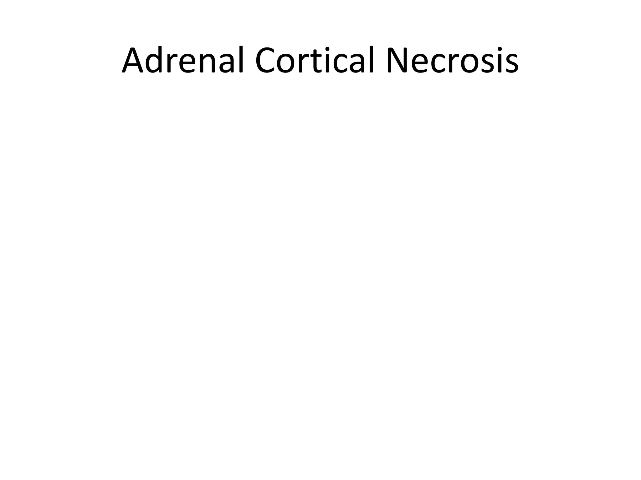 Adrenal Cortical Necrosis
 
