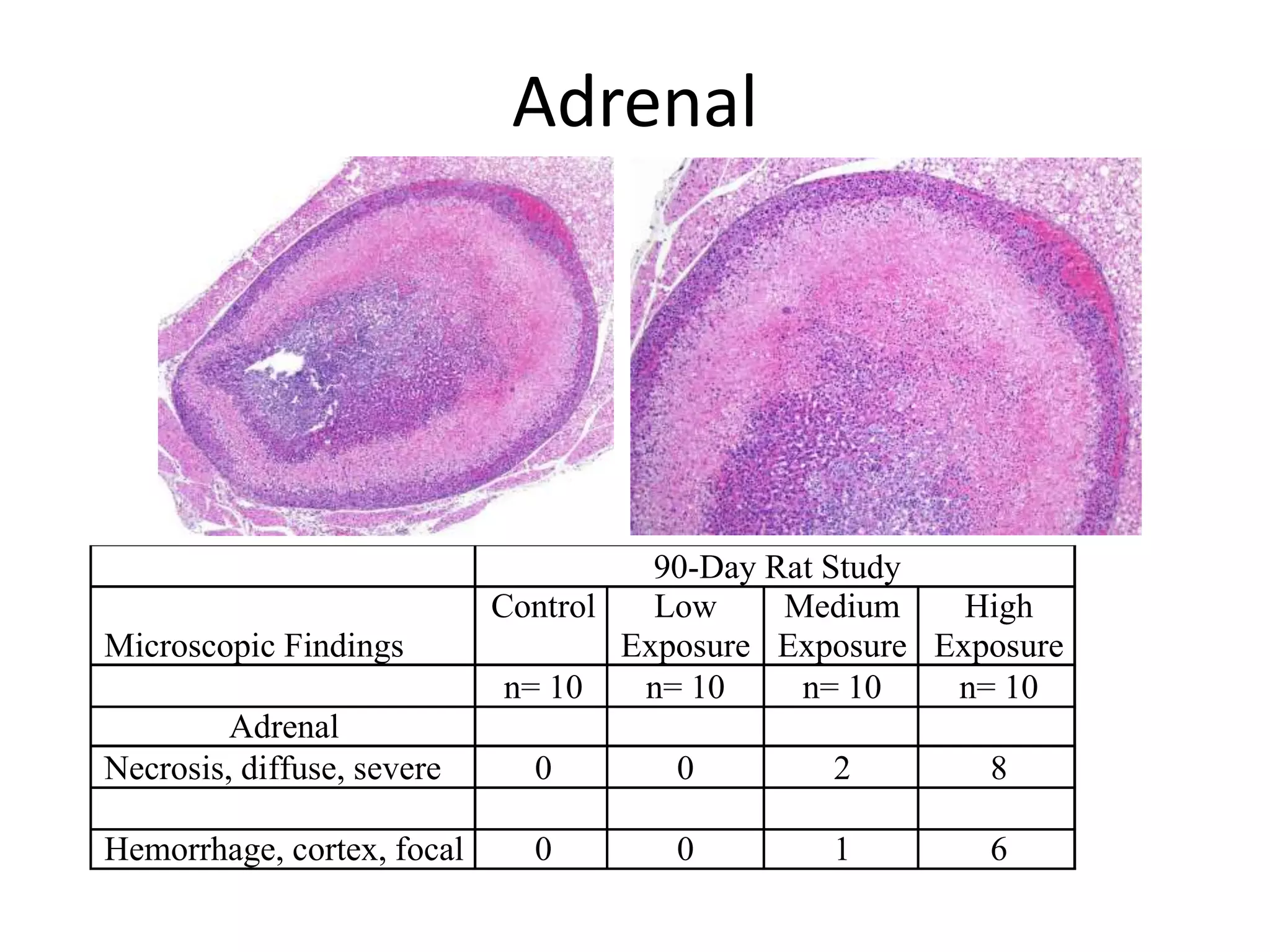 Adrenal
90-Day Rat Study
Microscopic Findings
Control Low
Exposure
Medium
Exposure
High
Exposure
n= 10 n= 10 n= 10 n= 10
Adrenal
Necrosis, diffuse, severe 0 0 2 8
Hemorrhage, cortex, focal 0 0 1 6
 