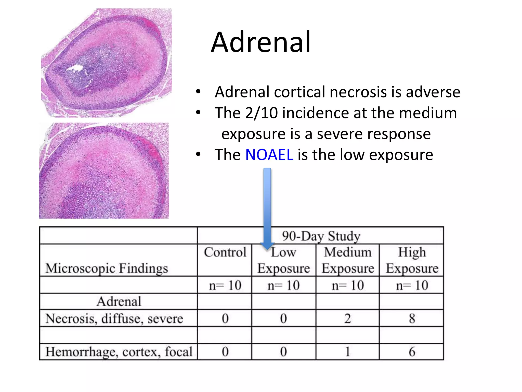 Adrenal
• Adrenal cortical necrosis is adverse
• The 2/10 incidence at the medium
exposure is a severe response
• The NOAEL is the low exposure
 