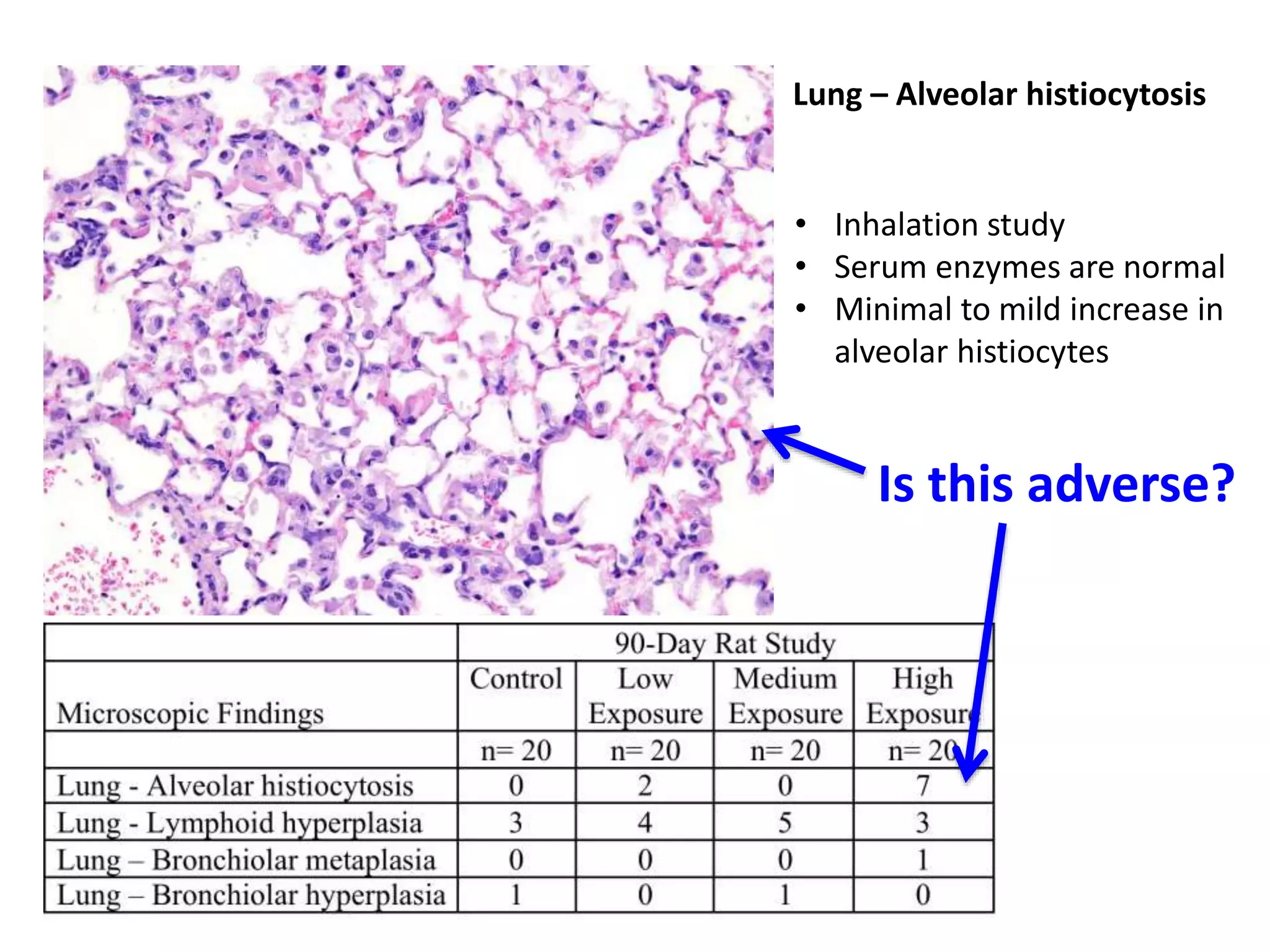 Lung – Alveolar histiocytosis
• Inhalation study
• Serum enzymes are normal
• Minimal to mild increase in
alveolar histiocytes
Is this adverse?
 