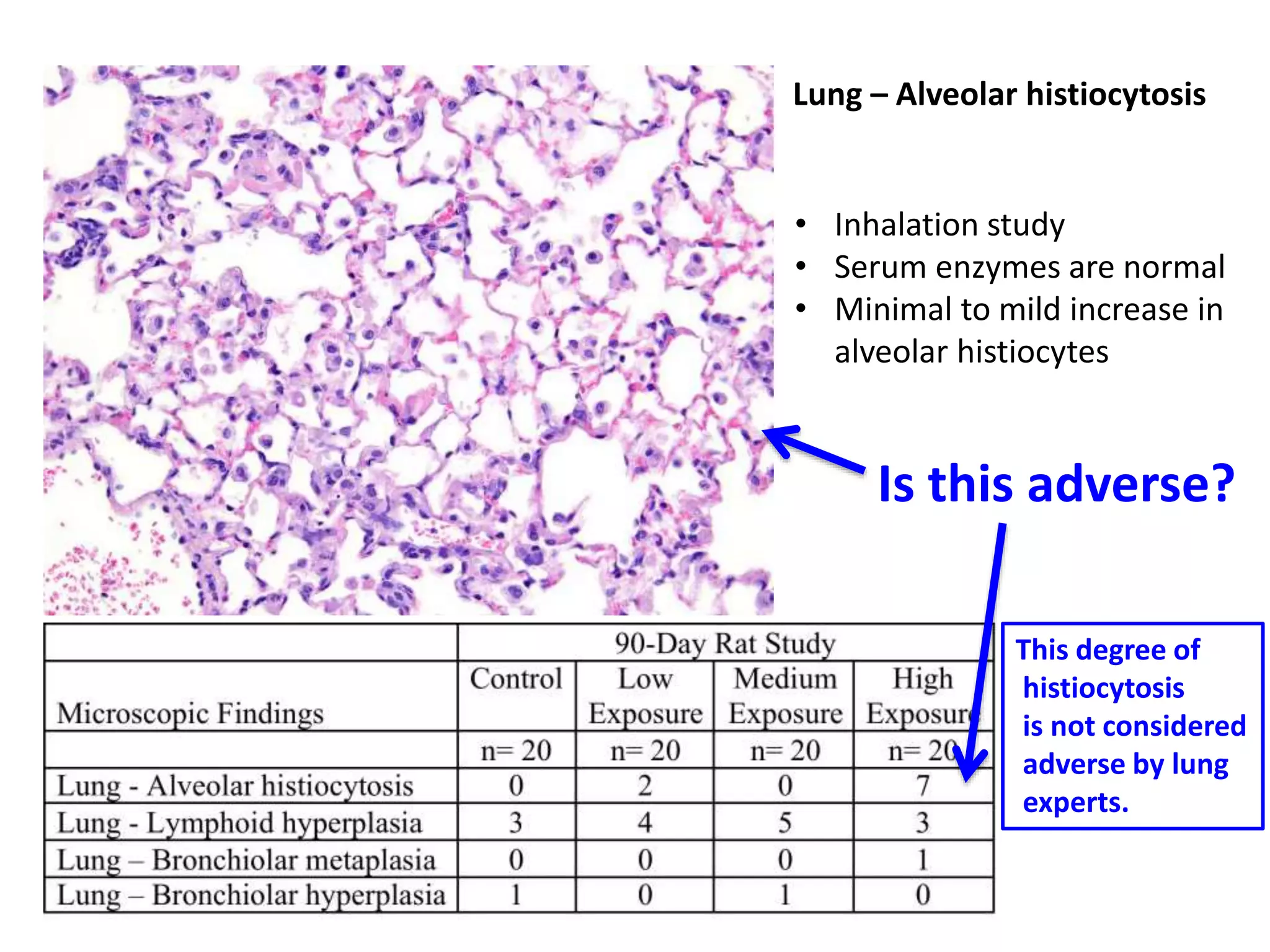 Lung – Alveolar histiocytosis
• Inhalation study
• Serum enzymes are normal
• Minimal to mild increase in
alveolar histiocytes
Is this adverse?
This degree of
histiocytosis
is not considered
adverse by lung
experts.
 