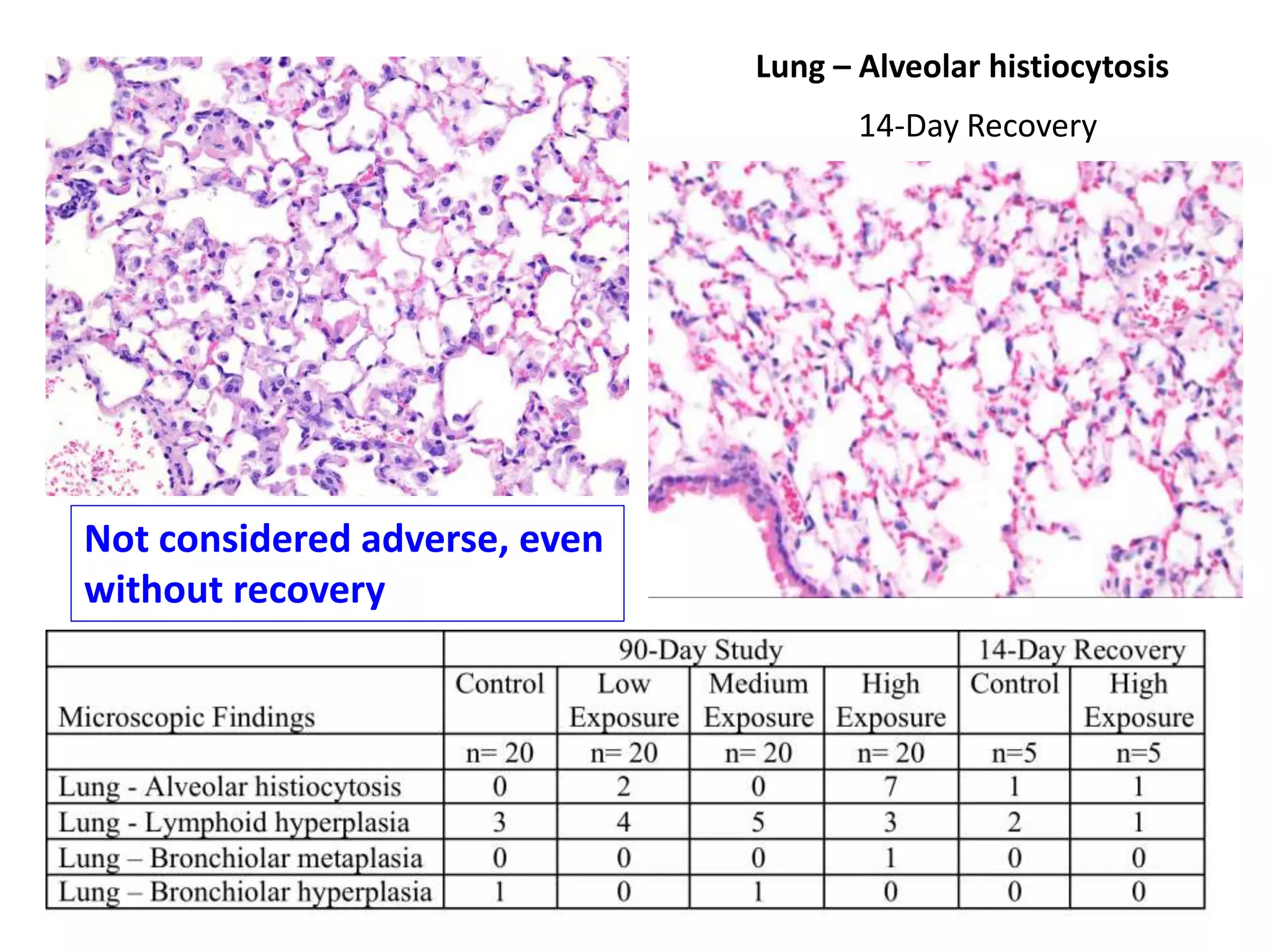 Lung – Alveolar histiocytosis
14-Day Recovery
Not considered adverse, even
without recovery
 