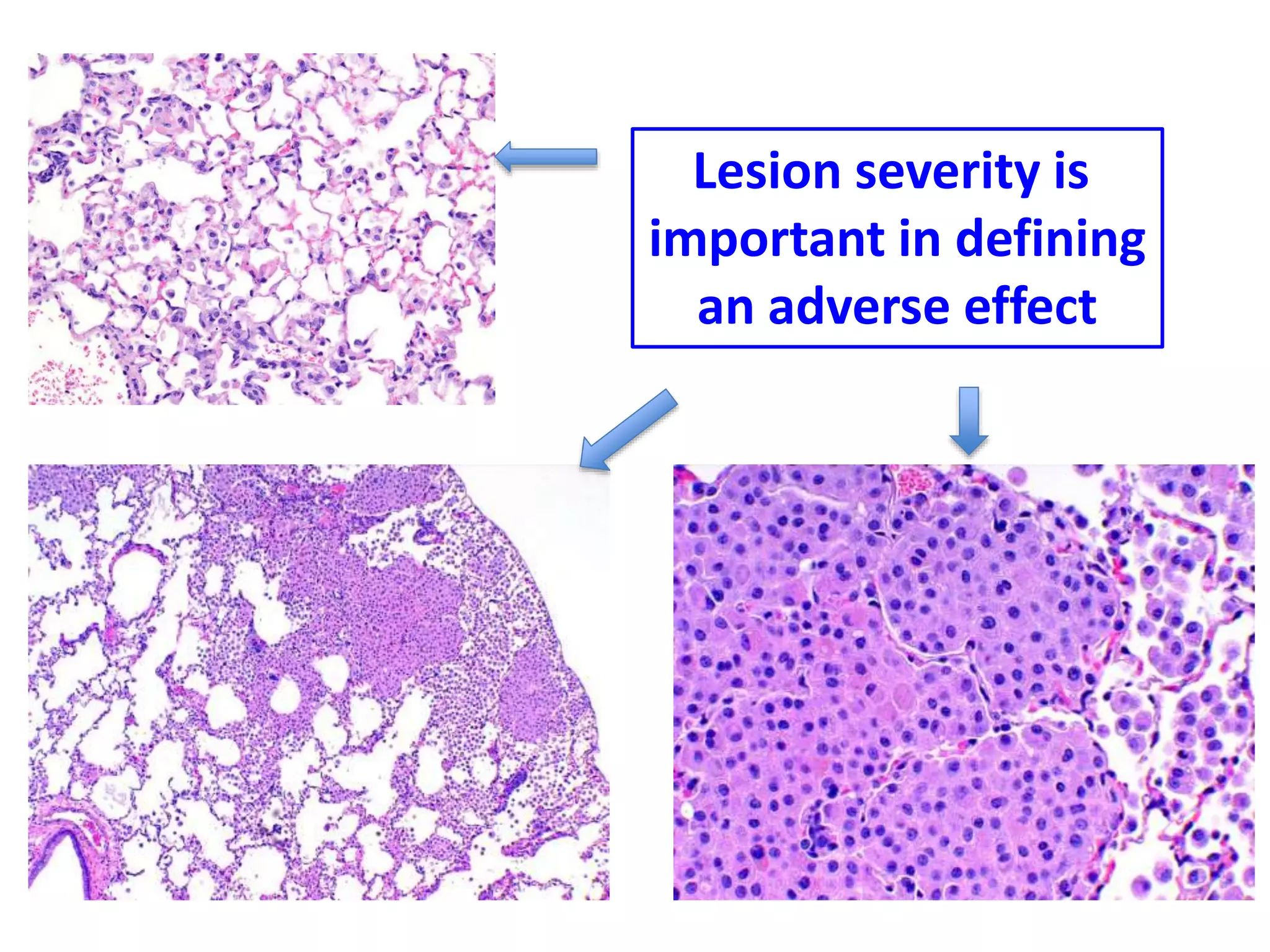 Lesion severity is
important in defining
an adverse effect
 