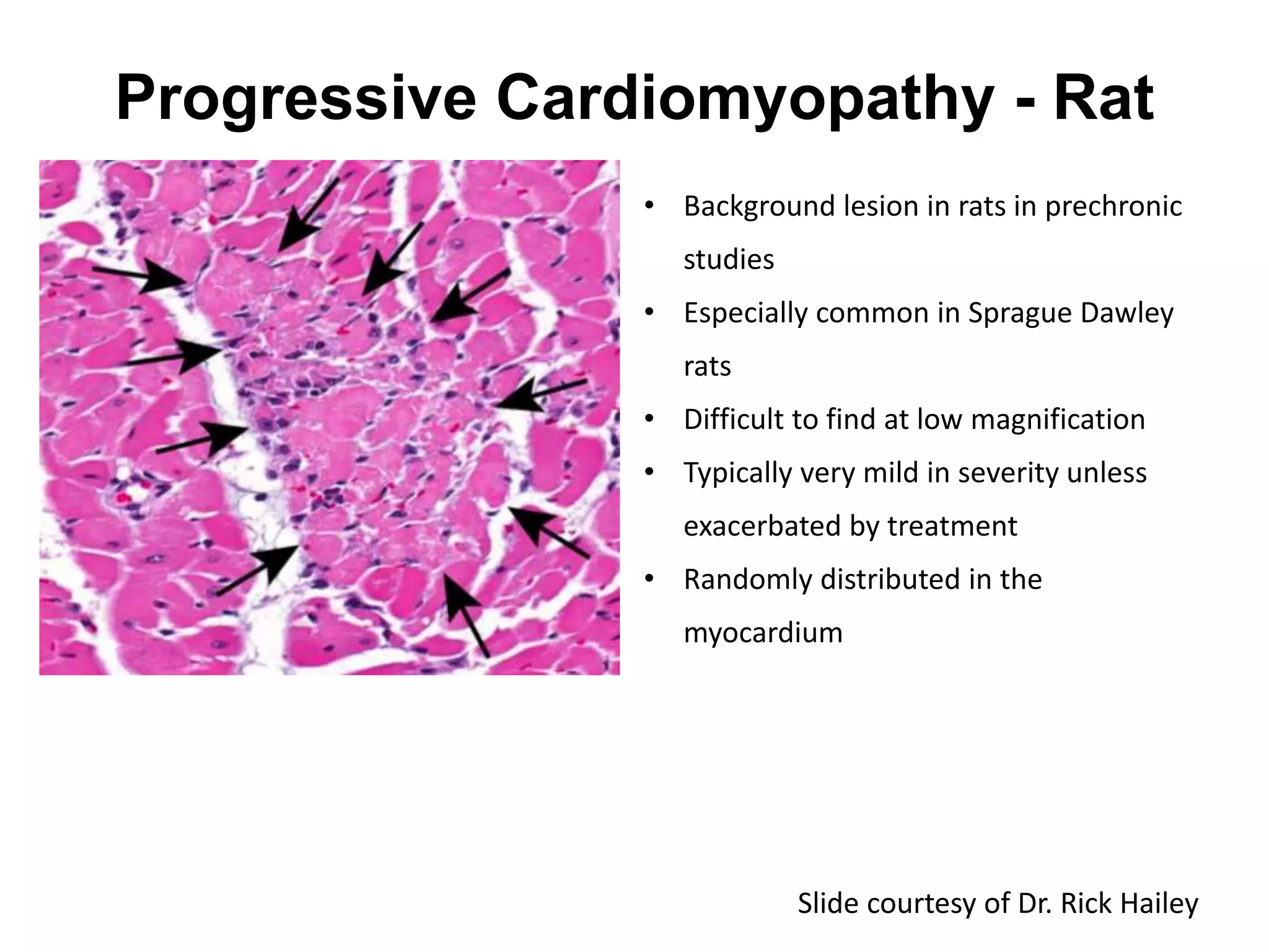 Progressive Cardiomyopathy - Rat
• Background lesion in rats in prechronic
studies
• Especially common in Sprague Dawley
rats
• Difficult to find at low magnification
• Typically very mild in severity unless
exacerbated by treatment
• Randomly distributed in the
myocardium
Slide courtesy of Dr. Rick Hailey
 