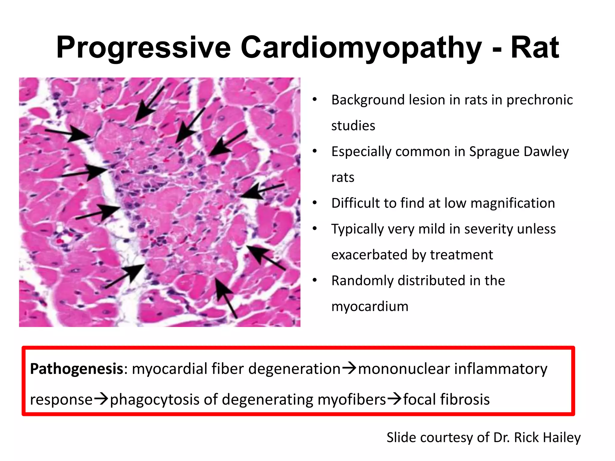 Progressive Cardiomyopathy - Rat
• Background lesion in rats in prechronic
studies
• Especially common in Sprague Dawley
rats
• Difficult to find at low magnification
• Typically very mild in severity unless
exacerbated by treatment
• Randomly distributed in the
myocardium
Pathogenesis: myocardial fiber degenerationmononuclear inflammatory
responsephagocytosis of degenerating myofibersfocal fibrosis
Slide courtesy of Dr. Rick Hailey
 