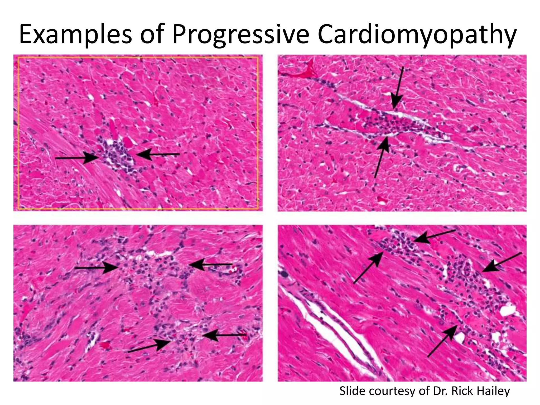Examples of Progressive Cardiomyopathy
Slide courtesy of Dr. Rick Hailey
 