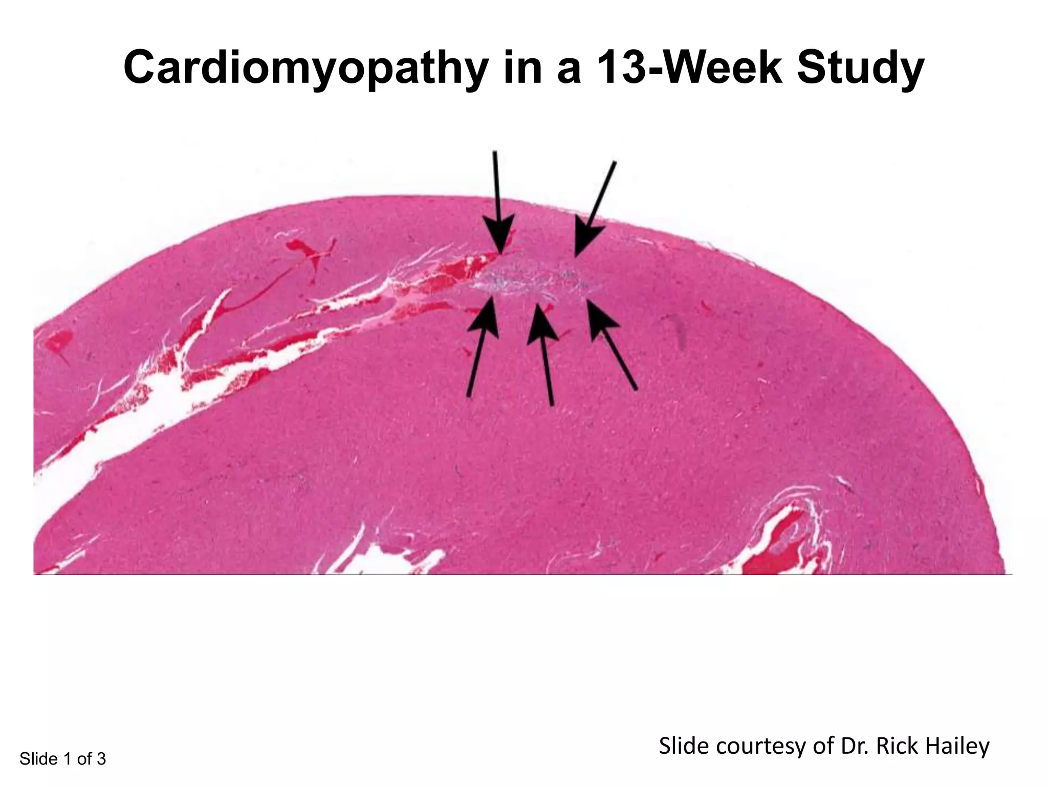 Slide 1 of 3
Cardiomyopathy in a 13-Week Study
Slide courtesy of Dr. Rick Hailey
 