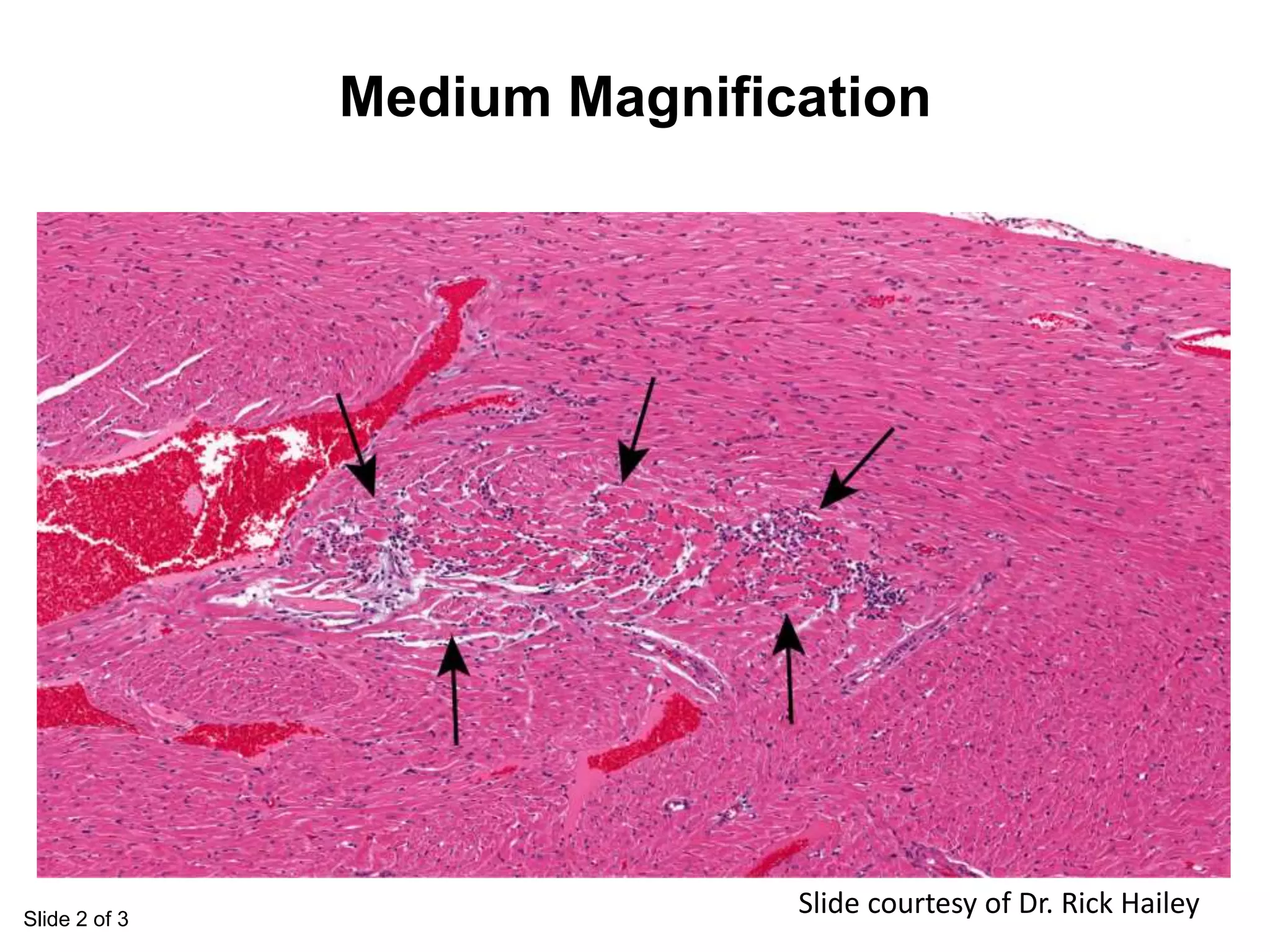 Slide 2 of 3
Medium Magnification
Slide courtesy of Dr. Rick Hailey
 