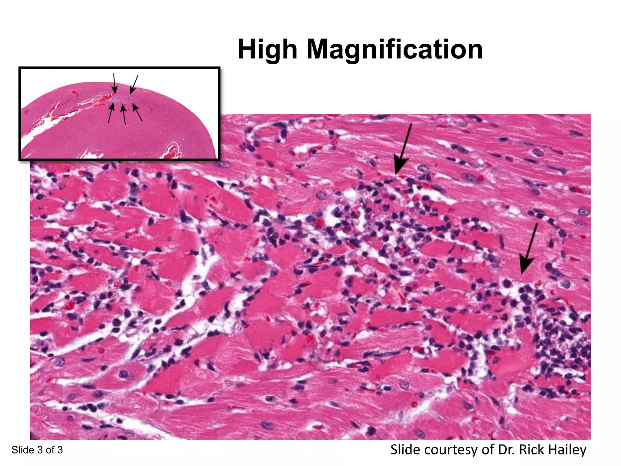 Slide 3 of 3
High Magnification
Slide courtesy of Dr. Rick Hailey
 