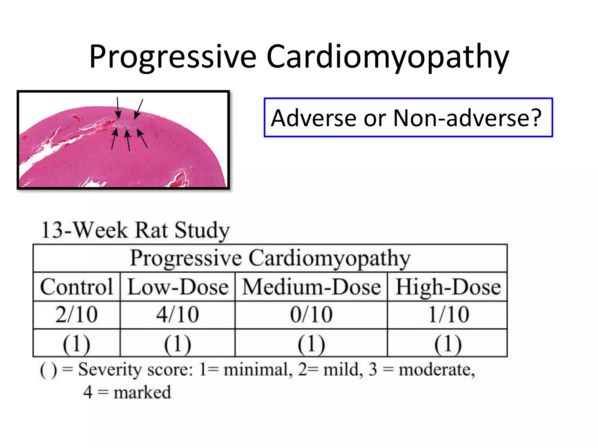 Progressive Cardiomyopathy
Adverse or Non-adverse?
 