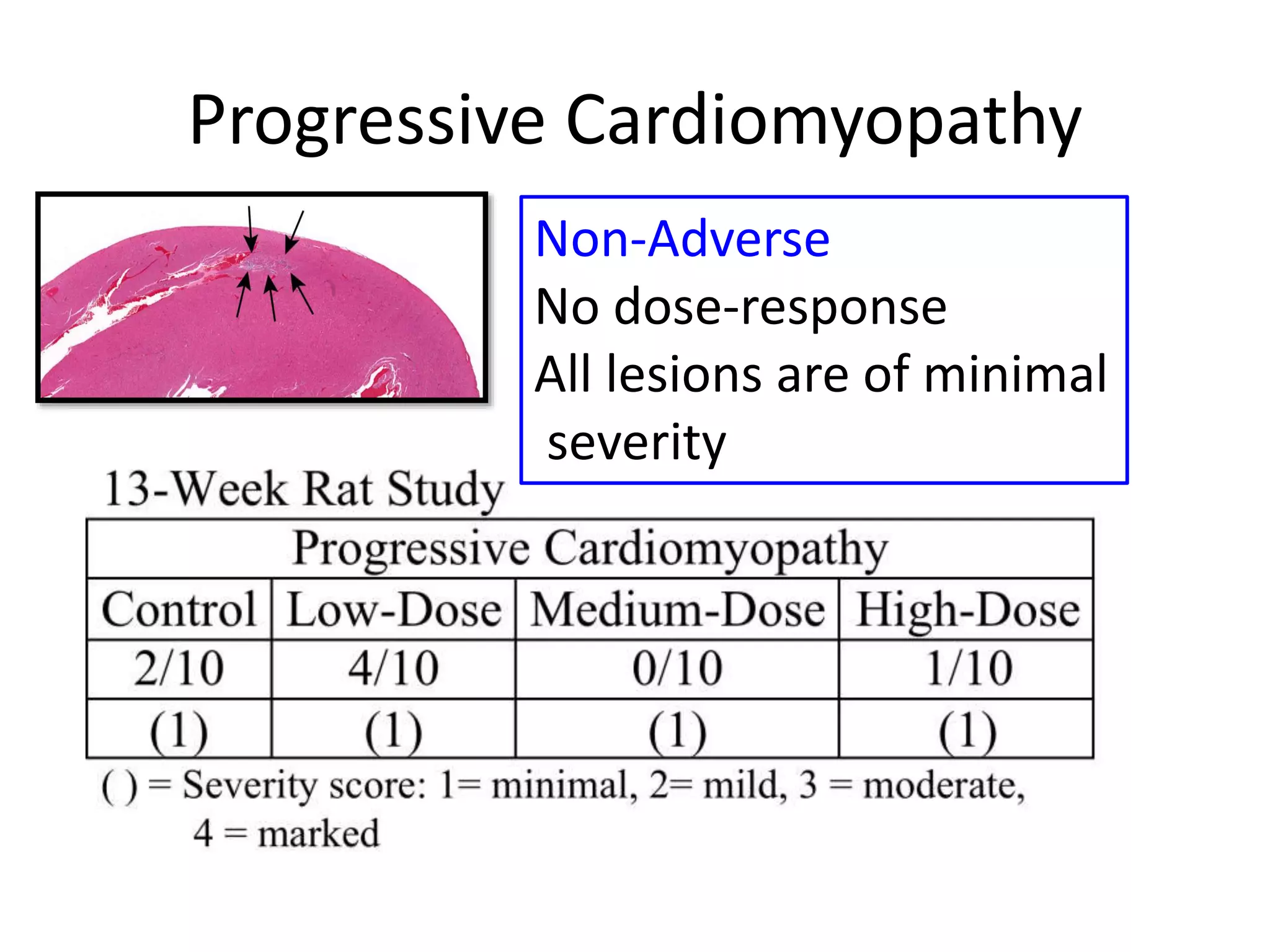 Progressive Cardiomyopathy
Non-Adverse
No dose-response
All lesions are of minimal
severity
 