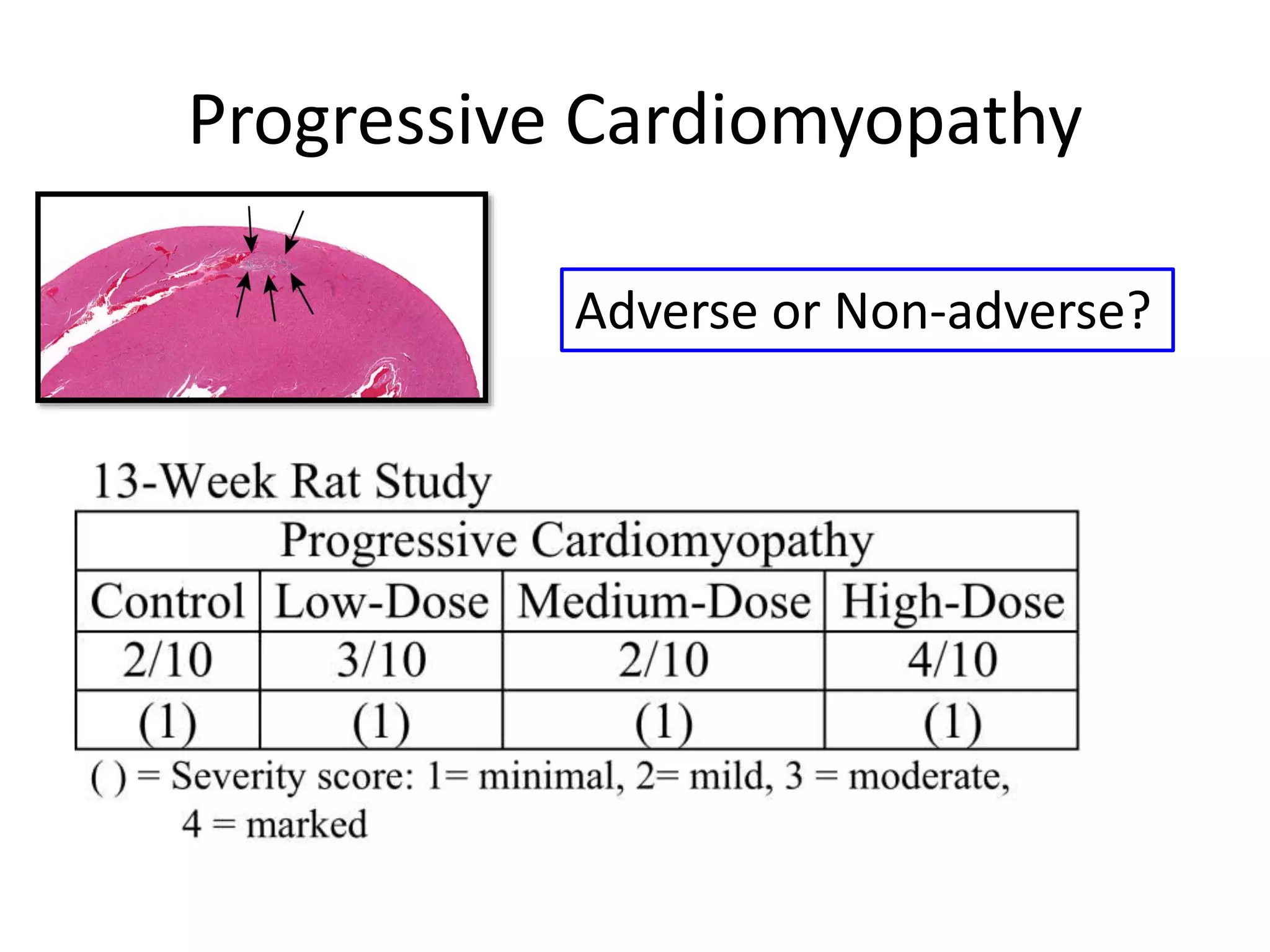 Progressive Cardiomyopathy
Adverse or Non-adverse?
 