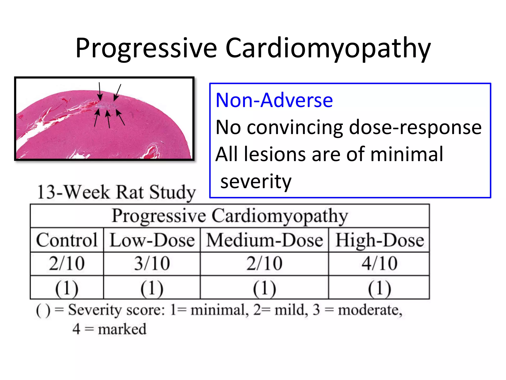 Progressive Cardiomyopathy
Non-Adverse
No convincing dose-response
All lesions are of minimal
severity
 