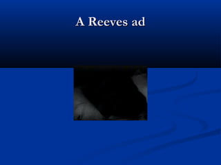 A Reeves adA Reeves ad
 