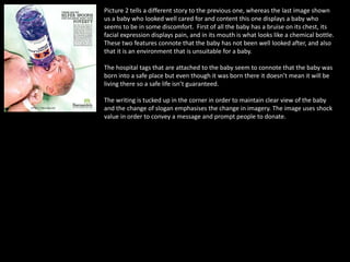Picture 2 tells a different story to the previous one, whereas the last image shown
us a baby who looked well cared for and content this one displays a baby who
seems to be in some discomfort. First of all the baby has a bruise on its chest, its
facial expression displays pain, and in its mouth is what looks like a chemical bottle.
These two features connote that the baby has not been well looked after, and also
that it is an environment that is unsuitable for a baby.
The hospital tags that are attached to the baby seem to connote that the baby was
born into a safe place but even though it was born there it doesn’t mean it will be
living there so a safe life isn’t guaranteed.
The writing is tucked up in the corner in order to maintain clear view of the baby
and the change of slogan emphasises the change in imagery. The image uses shock
value in order to convey a message and prompt people to donate.
 