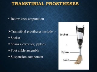 TRANSTIBIAL PROSTHESES
• Below knee amputation
Transtibial prostheses include :-
 Socket
 Shank (lower leg ,pylon)
 Foot ankle assembly
 Suspension component
32
 