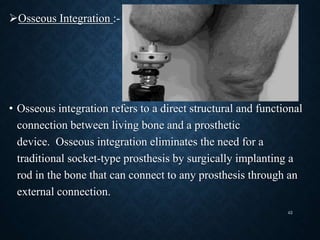 Osseous Integration :-
• Osseous integration refers to a direct structural and functional
connection between living bone and a prosthetic
device. Osseous integration eliminates the need for a
traditional socket-type prosthesis by surgically implanting a
rod in the bone that can connect to any prosthesis through an
external connection.
42
 