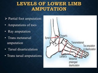 LEVELS OF LOWER LIMB
AMPUTATION
 Partial foot amputation:
• Amputations of toes
• Ray amputation
• Trans metatarsal
amputation
• Tarsal disarticulation
• Trans tarsal amputations
5
 