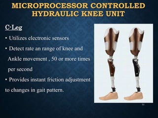 MICROPROCESSOR CONTROLLED
HYDRAULIC KNEE UNIT
C-Leg
• Utilizes electronic sensors
• Detect rate an range of knee and
Ankle movement , 50 or more times
per second
• Provides instant friction adjustment
to changes in gait pattern.
51
 