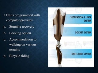 • Units programmed with
computer provides
a. Stumble recovery
b. Locking option
c. Accommodation to
walking on various
terrains
d. Bicycle riding
52
 