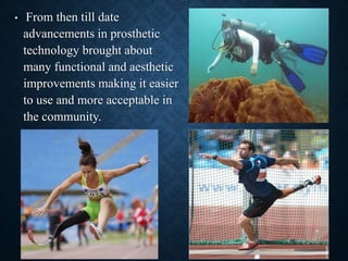 • From then till date
advancements in prosthetic
technology brought about
many functional and aesthetic
improvements making it easier
to use and more acceptable in
the community.
9
 