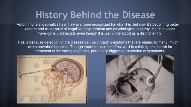 Encephalitis What Are The Symptoms And How Can It Be