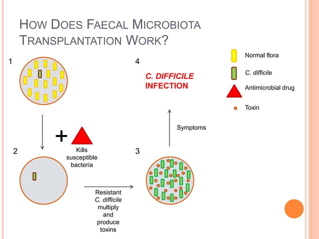 Treating Clostridium Difficile Infection With Faecal Microbiota ...