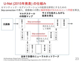 U-Net (2015k) ˽M
23
Ԫ










ޥƥå?Ʃ`νYrˤ뤿
Skip connection Ό룮sСH݆ʧȤ}Q
ޥ`
؏եޥå
򒈴󤷤ʤ
Yä



s
С



s
С










;

Y






;

Y

;

Y


K
Y

ȫǶӤΥ˥`ͥåȥ`
Skip connection
Skip connection
I
ʹ
I
ʹ
Olaf Ronneberger, Philipp Fischer, Thomas Brox,
U-Net: Convolutional Networks for Biomedical Image Segmentation, arXiv:1505.04597, 2015.
 