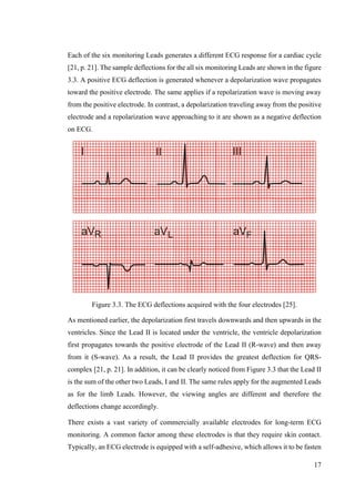 17
Each of the six monitoring Leads generates a different ECG response for a cardiac cycle
[21, p. 21]. The sample deflections for the all six monitoring Leads are shown in the figure
3.3. A positive ECG deflection is generated whenever a depolarization wave propagates
toward the positive electrode. The same applies if a repolarization wave is moving away
from the positive electrode. In contrast, a depolarization traveling away from the positive
electrode and a repolarization wave approaching to it are shown as a negative deflection
on ECG.
Figure 3.3. The ECG deflections acquired with the four electrodes [25].
As mentioned earlier, the depolarization first travels downwards and then upwards in the
ventricles. Since the Lead II is located under the ventricle, the ventricle depolarization
first propagates towards the positive electrode of the Lead II (R-wave) and then away
from it (S-wave). As a result, the Lead II provides the greatest deflection for QRS-
complex [21, p. 21]. In addition, it can be clearly noticed from Figure 3.3 that the Lead II
is the sum of the other two Leads, I and II. The same rules apply for the augmented Leads
as for the limb Leads. However, the viewing angles are different and therefore the
deflections change accordingly.
There exists a vast variety of commercially available electrodes for long-term ECG
monitoring. A common factor among these electrodes is that they require skin contact.
Typically, an ECG electrode is equipped with a self-adhesive, which allows it to be fasten
 