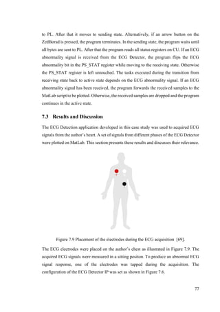 77
to PL. After that it moves to sending state. Alternatively, if an arrow button on the
ZedBorad is pressed, the program terminates. In the sending state, the program waits until
all bytes are sent to PL. After that the program reads all status registers on CU. If an ECG
abnormality signal is received from the ECG Detector, the program flips the ECG
abnormality bit in the PS_STAT register while moving to the receiving state. Otherwise
the PS_STAT register is left untouched. The tasks executed during the transition from
receiving state back to active state depends on the ECG abnormality signal. If an ECG
abnormality signal has been received, the program forwards the received samples to the
MatLab script to be plotted. Otherwise, the received samples are dropped and the program
continues in the active state.
7.3 Results and Discussion
The ECG Detection application developed in this case study was used to acquired ECG
signals from the author’s heart. A set of signals from different phases of the ECG Detector
were plotted on MatLab. This section presents these results and discusses their relevance.
Figure 7.9 Placement of the electrodes during the ECG acquisition [69].
The ECG electrodes were placed on the author’s chest as illustrated in Figure 7.9. The
acquired ECG signals were measured in a sitting positon. To produce an abnormal ECG
signal response, one of the electrodes was tapped during the acquisition. The
configuration of the ECG Detector IP was set as shown in Figure 7.6.
 