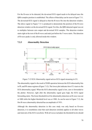 79
For the R-wave to be detected, the de-noised ECG signal needs to be delayed once the
QRS-complex position is established. The effects of that delay can be seen in Figure 7.11.
The de-noised ECG signal is delayed so that the R-wave fits into the detection window.
The above signal in Figure 7.11 is produced to demonstrate the position of the R-wave
detection window on the de-noised ECG signal. For this, the QRS detected signal was set
to multiplex between zero output and de-noised ECG samples. The detection window
starts right at the root of the R-wave and ends just before the T-wave starts. The detection
of R-wave peaks is only allowed inside this window.
7.3.3 Abnormality Detection
Figure 7.12 ECG Abnormality signal actives ECG signal streaming in CU.
The abnormality signal is the result of XOR operation between the ECG abnormality bits
in PL and PS status registers (Figure 7.12). The lower plot indicates how CU reacts to the
ECG abnormality signal. When the ECG abnormality signal is low, zero is forwarded to
the plotter. However, right after the abnormality signal goes high, the ECG signal
forwarding starts. The lower threshold level for abnormality detection on R-wave was set
at 1000 while the higher threshold level was at 1900. As can be seen in Figure 7.12, the
first R-wave abnormality detected has an amplitude of 1931.
Although the abnormality detection in this case study was only based on R-wave
detection, it is nonetheless clear that such detection similarly applies to all other waves
and intervals of the ECG waveform. With all waves included, the threshold levels should
 