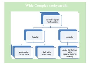 Wide Complex tachycardia
 