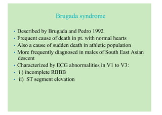 Brugada syndrome
• Described by Brugada and Pedro 1992
• Frequent cause of death in pt. with normal hearts
• Also a cause of sudden death in athletic population
• More frequently diagnosed in males of South East Asian
descent
• Characterized by ECG abnormalities in V1 to V3:
• i ) incomplete RBBB
• ii) ST segment elevation
 
