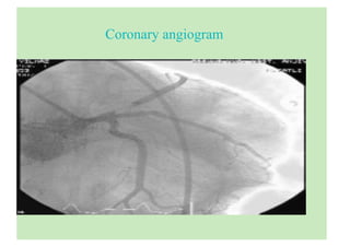 Coronary angiogram
 
