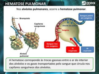 HEMATOSE PULMONAR
Nos alvéolos pulmonares, ocorre a hematose pulmonar.
A hematose corresponde às trocas gasosas entre o ar do interior
dos alvéolos e os gases transportados pelo sangue que circula nos
capilares sanguíneos dos alvéolos.
Bronquíolo
Alvéolo
pulmonar
Capilares
sanguíneos
Sangue rico
em oxigénio
Sangue pobre
em oxigénio
Ar
inspirado
Ar
expirado
Oxigénio
Dióxido de carbono
 