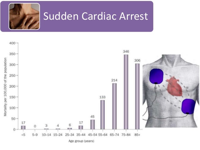 sudden cardiac arrest Sudden cardiac arrest a fact sheet for student athletes facts sudden cardiac arrest can occur even in athletes who are in peak shape approximately. sudden cardiac arrest Sudden cardiac arrest a fact sheet for student athletes facts sudden cardiac arrest can occur even in athletes who are in peak shape approximately.