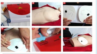 Comprehensive Guide to AED Use and Emergency Resuscitation Techniques ...