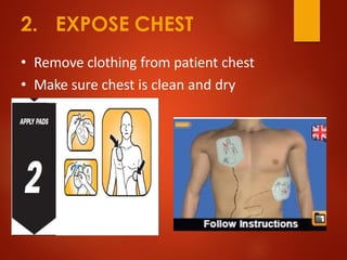 2. EXPOSE CHEST
• Remove clothing from patient chest
• Make sure chest is clean and dry
 