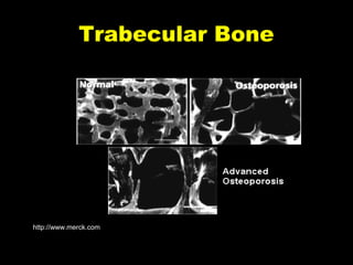 Trabecular Bone

http://www.merck.com
P-Slide 11

 
