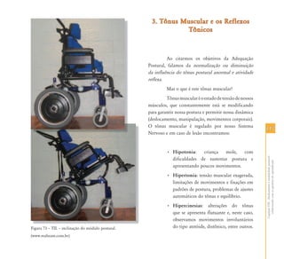 117117
CapítuloVIII-Alinhamentoeestabilidadepostural:
colaborandocomasquestõesdoaprendizado
Figura 73 – TIL – inclinação do módulo postural.
(www.realteam.com.br)
3. Tônus Muscular e os Reflexos3. Tônus Muscular e os Reflexos
TônicosTônicos
Ao citarmos os objetivos da Adequação
Postural, falamos da normalização ou diminuição
da influência do tônus postural anormal e atividade
reflexa.
Mas o que é este tônus muscular?
Tônusmuscularéoestadodetensãodenossos
músculos, que constantemente está se modificando
para garantir nossa postura e permitir nossa dinâmica
(deslocamento, manipulação, movimentos corporais).
O tônus muscular é regulado por nosso Sistema
Nervoso e em caso de lesão encontramos:
• Hipotonia: criança mole, com
dificuldades de sustentar postura e
apresentando poucos movimentos.
• Hipertonia: tensão muscular exagerada,
limitações de movimentos e fixações em
padrões de postura, problemas de ajustes
automáticos do tônus e equilíbrio.
• Hipercinesias: alterações do tônus
que se apresenta flutuante e, neste caso,
observamos movimentos involuntários
do tipo atetóide, distônico, entre outros.Fi 73 TIL i li ã d ód l l
 