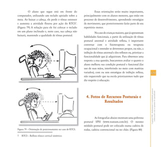 O aluno que segue está em frente do                          Essas orientações serão muito importantes,
computador, utilizando um teclado apoiado sobre a           principalmente com os alunos menores, que estão em
mesa. Ao baixar a cabeça, ele perde o tônus extensor        processo de desenvolvimento, aprendendo estratégias
e aumenta a atividade flexora por ação do RTCS7.            de movimento, que posteriormente farão parte de seu
(Figura 79) A solução para ele foi colocar o teclado        repertório motor.
em um plano inclinado e, neste caso, sua cabeça não                   No caso de crianças maiores, que já apresentam
baixará, mantendo a qualidade de tônus postural.            habilidades funcionais, a partir da utilização de tônus
                                                            postural anormal e atividade reflexa, é importante
                                                            conversar com o fisioterapeuta ou terapeuta
                                                            ocupacional e entender se deveremos propor, ou não, a
                                                            inibição do tônus anormal e dos reflexos ou, priorizar a
                                                            funcionalidade que já adquiriram. Para obtermos uma
                                                            resposta a essa questão, buscaremos avaliar o quanto o
                                                            aluno melhora sua condição postural e funcional (faz
                                                            uso de suas mãos, interferindo no meio com matérias
                                                            variados), com ou sem estratégias de inibição reflexa,     121
                                                            não esquecendo que na escola priorizaremos tudo que
                                                            diz respeito à educação.




                                                                                                                       Capítulo VIII - Alinhamento e estabilidade postural:
                                                                                                                         colaborando com as questões do aprendizado
                                                              4. Fotos de Recursos Posturais e
                                                                         Resultados



                                                                      As fotografias abaixo mostram uma poltrona
                                                            postural SPH (www.reateam.com.br). O mesmo
                                                            módulo postural pode ser colocado numa cadeira de
Figura 79 – Orientação de posicionamento no caso de RTCS.   rodas, cadeira convencional ou no chão. (Figura 80)

7   RTCS – Reflexo tônico cervical simétrico.
 
