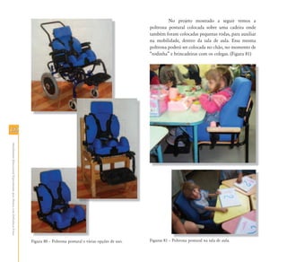 No projeto mostrado a seguir vemos a
                                                                                                                                    poltrona postural colocada sobre uma cadeira onde
                                                                                                                                    também foram colocadas pequenas rodas, para auxiliar
                                                                                                                                    na mobilidade, dentro da sala de aula. Essa mesma
                                                                                                                                    poltrona poderá ser colocada no chão, no momento de
                                                                                                                                    “rodinha” e brincadeiras com os colegas. (Figura 81)




122
 Atendimento Educacional Especializado para Alunos com Deficiência Física




                                                                            Figura 80 – Poltrona postural e várias opções de uso.   Figuras 81 – Poltrona postural na sala de aula
                                                                                                                                                                              aula.
 