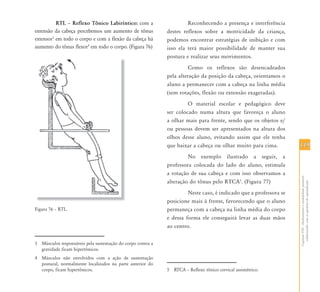 119119
CapítuloVIII-Alinhamentoeestabilidadepostural:
colaborandocomasquestõesdoaprendizado
RTL – Reflexo Tônico Labiríntico: com a
extensão da cabeça percebemos um aumento de tônus
extensor3
em todo o corpo e com a flexão da cabeça há
aumento do tônus flexor4
em todo o corpo. (Figura 76)
Figura 76 – RTL.
3 Músculos responsáveis pela sustentação do corpo contra a
gravidade ficam hipertônicos.
4 Músculos não envolvidos com a ação de sustentação
postural, normalmente localizados na parte anterior do
corpo, ficam hipertônicos.
Reconhecendo a presença e interferência
destes reflexos sobre a motricidade da criança,
podemos encontrar estratégias de inibição e com
isso ela terá maior possibilidade de manter sua
postura e realizar seus movimentos.
Como os reflexos são desencadeados
pela alteração da posição da cabeça, orientamos o
aluno a permanecer com a cabeça na linha média
(sem rotações, flexão ou extensão exageradas).
O material escolar e pedagógico deve
ser colocado numa altura que favoreça o aluno
a olhar mais para frente, sendo que os objetos e/
ou pessoas devem ser apresentados na altura dos
olhos desse aluno, evitando assim que ele tenha
que baixar a cabeça ou olhar muito para cima.
No exemplo ilustrado a seguir, a
professora colocada do lado do aluno, estimula
a rotação de sua cabeça e com isso observamos a
alteração do tônus pelo RTCA5
. (Figura 77)
Neste caso, é indicado que a professora se
posicione mais à frente, favorecendo que o aluno
permaneça com a cabeça na linha média do corpo
e dessa forma ele conseguirá levar as duas mãos
ao centro.
5 RTCA – Reflexo tônico cervical assimétrico.
 