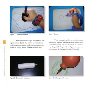 4444
AtendimentoEducacionalEspecializadoparaAlunoscomDeficiênciaFísica
Figura 7 – Pulseira imantada.
Um engrossador de lápis pode ser feito com
espuma macia (Figura 8) e órteses podem melhorar a
posição da mão do aluno e ainda conter um dispositivo
para fixar o lápis. (Figura 9) (www.expansao.com).
Figura 8 – Engrossador de espuma.
Figura 9 - Órtese.
Várias adaptações podem ser confeccionadas,
utilizando-se materiais que originalmente tinham outra
função. Uma bola de borracha encontrada em farmácias
e que faz parte do “sugador de leite” pode tornar-se um
recurso ótimo de adaptação do lápis. (Figura 10)
Figura 10 – Adaptação de borracha.
Figura 7 – Pulseira imantada
Fi 8 E d d Fi 10 Ad ã d b h
 