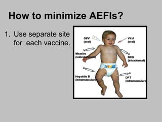 How to minimize AEFIs? Use separate site for  each vaccine. 