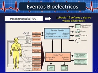 Indice
12
Polisomnografía(PSG) ¡¡¡Hasta 15 señales y signos
vitales diferentes!!!
Eventos Bioeléctricos
 