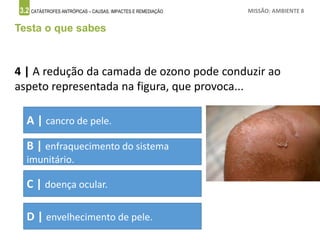 3.2 CATÁSTROFES ANTRÓPICAS – CAUSAS, IMPACTES E REMEDIAÇÃO MISSÃO: AMBIENTE 8
Testa o que sabes
4 | A redução da camada de ozono pode conduzir ao
aspeto representada na figura, que provoca...
A | cancro de pele.
B | enfraquecimento do sistema
imunitário.
C | doença ocular.
D | envelhecimento de pele.
 