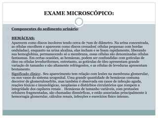 EXAME MICROSCÓPICO: 
Componentes do sedimento urinário: 
HEMÁCEAS: 
Aparecem como discos incolores tendo cerca de 7um de diâmetro. Na urina concentrada, 
as células encolhem e aparecem como discos crenados( células pequenas com bordas 
onduladas), enquanto na urina alcalina, elas incham e se lisam rapidamente, liberando 
sua hemoglobina, permanecendo só a membrana, essas células são denominadas células 
fantasmas. Em certas ocasiões, as hemáceas, podem ser confundidas com gotículas de 
óleo ou células leveduriformes, entretanto, as gotículas de óleo apresentam grande 
variação de tamanho e são altamente refringentes, e as células de leveduras apresentam 
brotamento. 
Significado clínico:. Seu aparecimento tem relação com lesões na membrana glomerular, 
ou nos vasos do sistema urogenital. Uma grande quantidade de hemáceas costuma 
decorrer de glomerulonefrite, mas também é observada em casos de infecção aguda, 
reações tóxicas e imunológicas, neoplasias e distúrbios circulatórios que rompem a 
integridade dos capilares renais . Hemáceas de tamanho variáveis, com protusões 
celulares fragmentadas, são chamadas dismórficas, e estão associadas principalmente à 
hemorragia glomerular, cálculos renais, infecções e exercícios físico intenso. 
 