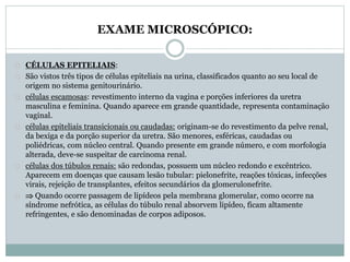 EXAME MICROSCÓPICO: 
CÉLULAS EPITELIAIS: 
São vistos três tipos de células epiteliais na urina, classificados quanto ao seu local de 
origem no sistema genitourinário. 
células escamosas: revestimento interno da vagina e porções inferiores da uretra 
masculina e feminina. Quando aparece em grande quantidade, representa contaminação 
vaginal. 
células epiteliais transicionais ou caudadas: originam-se do revestimento da pelve renal, 
da bexiga e da porção superior da uretra. São menores, esféricas, caudadas ou 
poliédricas, com núcleo central. Quando presente em grande número, e com morfologia 
alterada, deve-se suspeitar de carcinoma renal. 
células dos túbulos renais: são redondas, possuem um núcleo redondo e excêntrico. 
Aparecem em doenças que causam lesão tubular: pielonefrite, reações tóxicas, infecções 
virais, rejeição de transplantes, efeitos secundários da glomerulonefrite. 
 Quando ocorre passagem de lipídeos pela membrana glomerular, como ocorre na 
síndrome nefrótica, as células do túbulo renal absorvem lipídeo, ficam altamente 
refringentes, e são denominadas de corpos adiposos. 
 